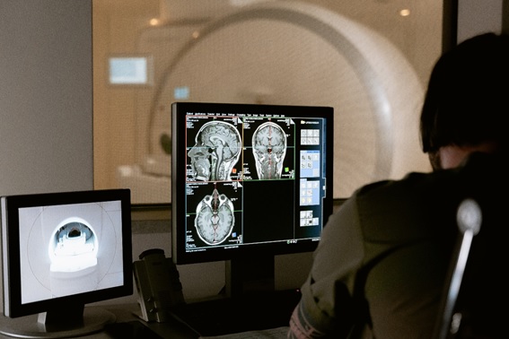 Alzheimer: como a radiologia pode ajudar no diagnóstico